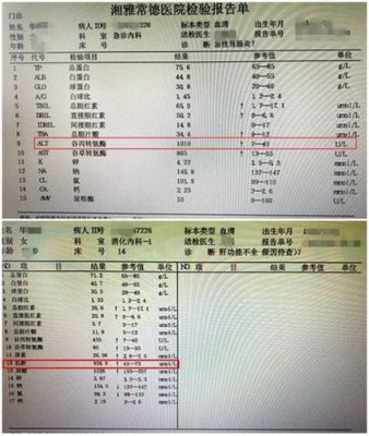 c判断两个值哪个大（脂肪肝通过哪个值判断的）