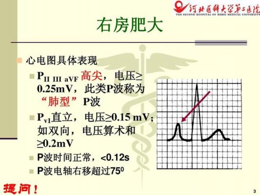 电子心电图怎么做（一学就会心电图电子版）-图2