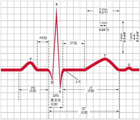 ecg信号无效怎么办（ecg2信号饱和什么意思）-图3