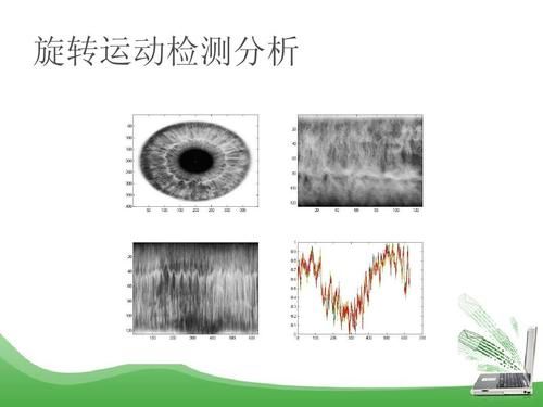 眼球运动轨迹设备（眼球轨迹运动检查临床意义）