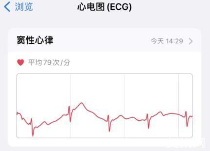 ecg标准（ECG标准AHA）-图3