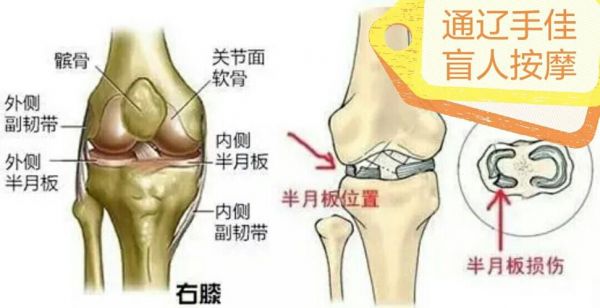 在哪个位置（半月板在哪个位置）-图2