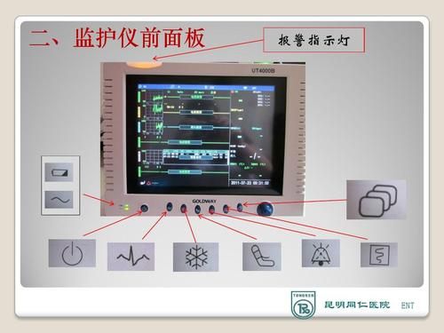 心电监护仪怎么开机（心电监护仪开机键）-图3