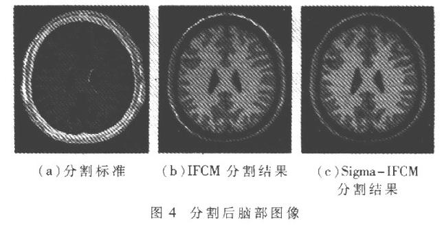 i-mr图中mr标准（mr图是什么）-图2