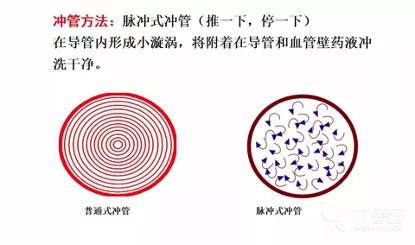 怎么解决滞留脉冲问题（滞留现象）-图3