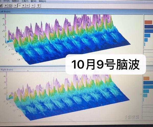 脑波设备（脑波仪测试解读）