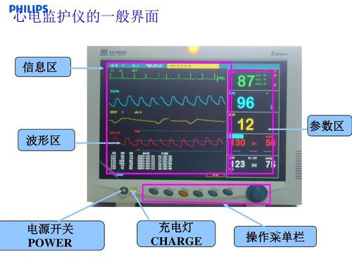 心电监护仪怎么充电（心电监护仪怎么充电?关着充还是开着充）-图3