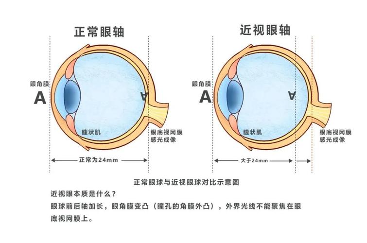 模板标准眼怎么处理（模板标准眼间距）-图1