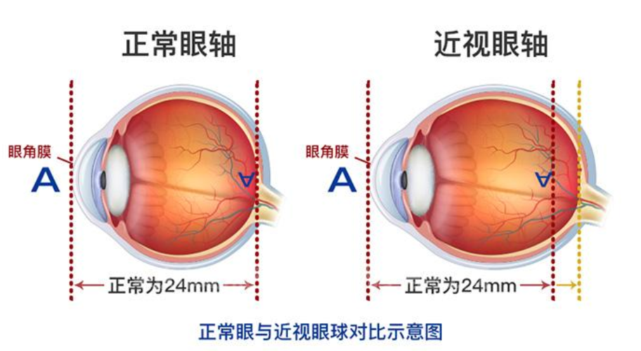 模板标准眼怎么处理（模板标准眼间距）-图3