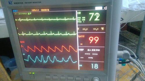 心电图监视仪怎么观察（心电监视仪器怎么看）