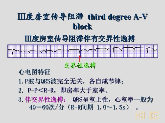 传导ydt983标准（传导率是什么意思）