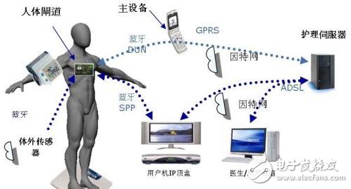 医疗传感器行业标准（医疗传感器是什么）-图3