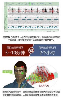 穿戴式睡眠检测设备（穿戴设备测试睡眠的原理）-图1