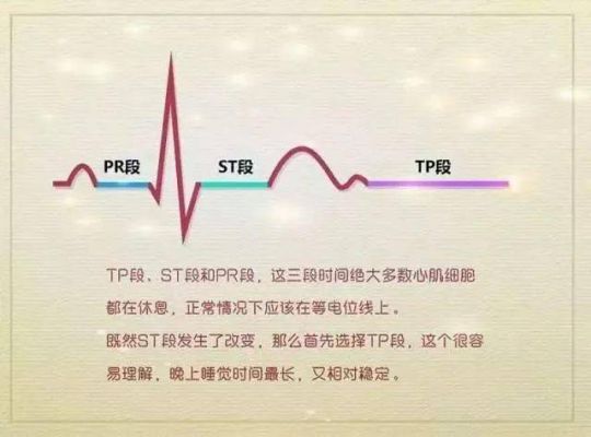 st标准库包含哪些内容（新st标准）-图1