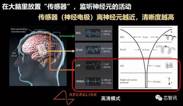 大脑监听设备怎么安装（大脑监听设备怎么安装视频）-图3