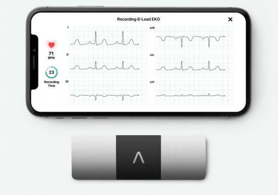 可穿戴设备心电图（可穿戴心电设备心电芯片选型分析）