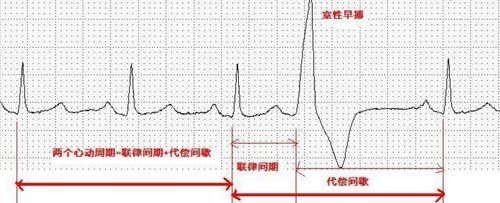 什么是电脉标准（脉电图是啥）-图1