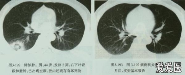 塑封料内部空洞标准（塑封体空洞分析）-图3