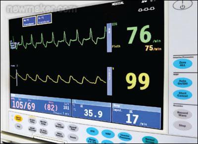 心电图设备如何检测（心电图检测器怎么看）