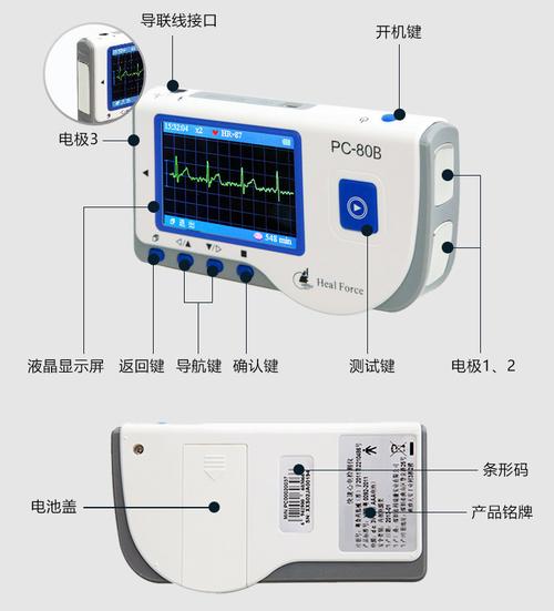 心电图设备如何检测（心电图检测器怎么看）-图2